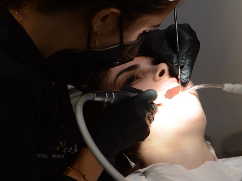 Aesthetic Dentistry Clinic, Istanbul Türkei - Ästhetische Zahnheilkunde Anwendungen